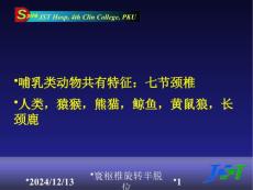 医学医疗-寰枢椎旋转半脱位课件