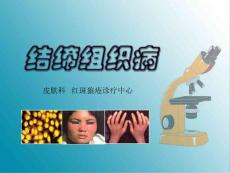 -结缔组织病课件