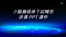 小脑扁桃体下疝畸形讲课PPT课件【28页】