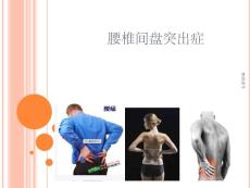 腰椎间盘突出症