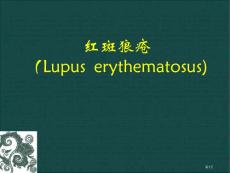 红斑狼疮课件培训课件