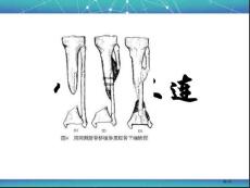 骨不连专题知识宣讲培训课件
