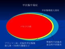 慢性甲状腺炎桥本病