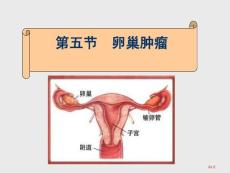卵巢肿瘤护理