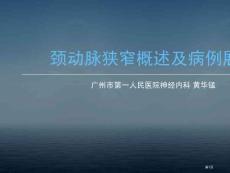 颈动脉狭窄概述和病例