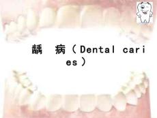 龋齿【26页】