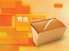 胃癌【21页】