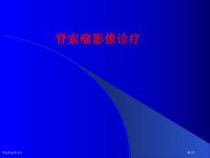 脊索瘤影像诊疗