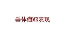 垂体瘤MR表现