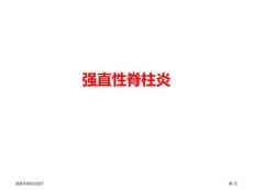 强直性脊柱炎医疗