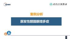 案例分析原发性醛固酮增多症