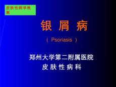 银屑病【55页】