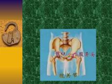 髋关节脱位课件培训课件
