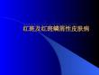 红斑及红斑鳞性皮肤病红斑PPT培训课件