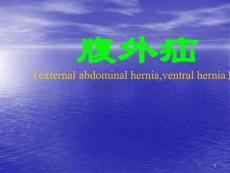 腹外疝课件