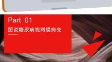 图说糖尿病视网膜病变