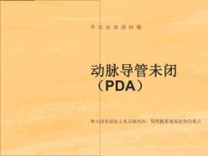 动脉导管未闭ppt