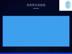 系统性红斑狼疮的