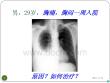 胸腔积液课件