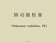 肺动脉栓塞的诊治
