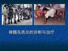 脊髓灰质炎医学PPT