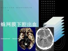 蛛网膜下腔出血教案