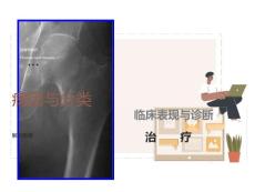 股骨颈骨折PPT