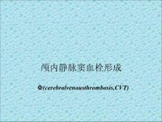 颅内静脉窦血栓形成