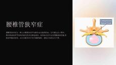 《腰椎管狭窄症》课件