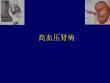 高血压肾病【15页】_190