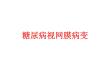 糖尿病视网膜病变