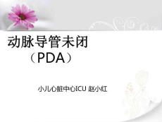 赵小红动脉导管未闭
