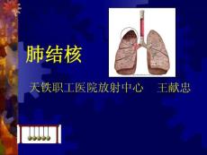 肺结核