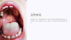 《急性喉炎》课件