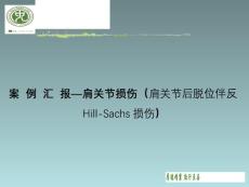 肩关节损伤肩关节后脱位伴反HillSachs损伤