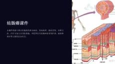 《结肠癌课件》课件