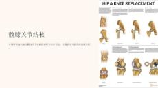 《髋膝关节结核》课件