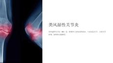 《类风湿性关节炎》课件