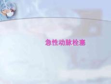 急性动脉栓塞