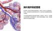 《肺大疱并发症管理》课件