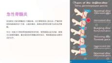《急性脊髓炎》课件