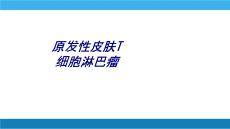 原发性皮肤T细胞淋巴瘤讲义