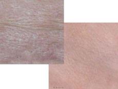 神秘肌肤奥秘探究培训课件