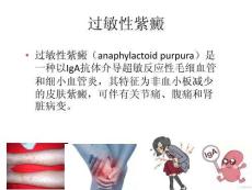 《皮肤性病学》过敏性紫癜附属器