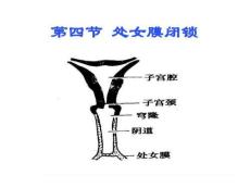 女性私密手术术后护理指南培训课件