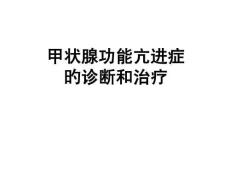 甲亢课件
