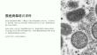 猴痘病毒培訓(xùn)課件