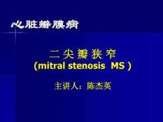 二尖瓣狭窄