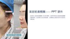 《面部轮廓精雕》课件