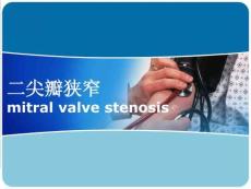 二尖瓣狹窄最新版本